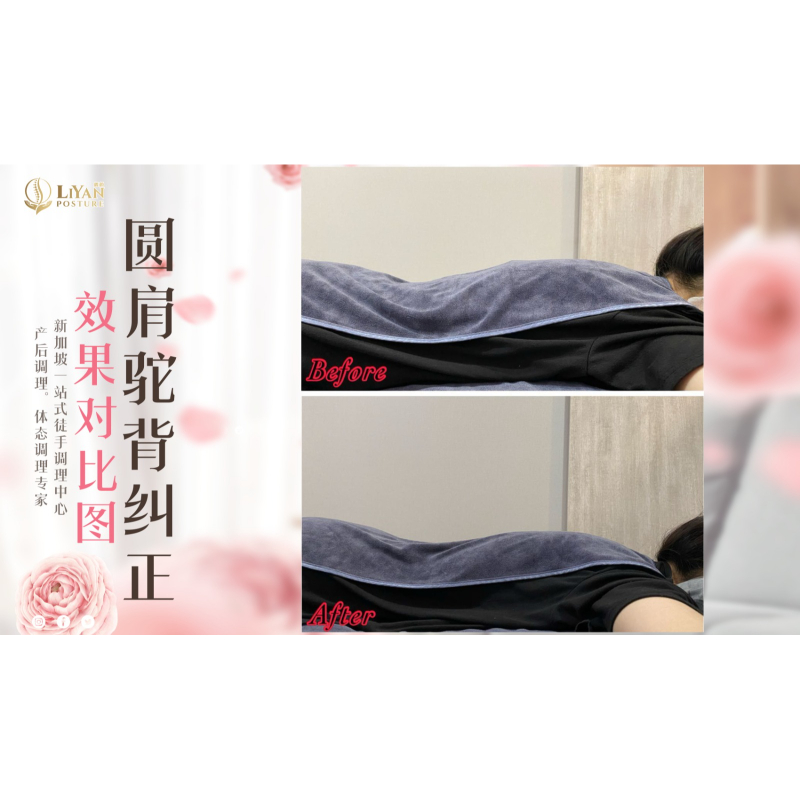 LiYan Special Posture Adjustment Bundle