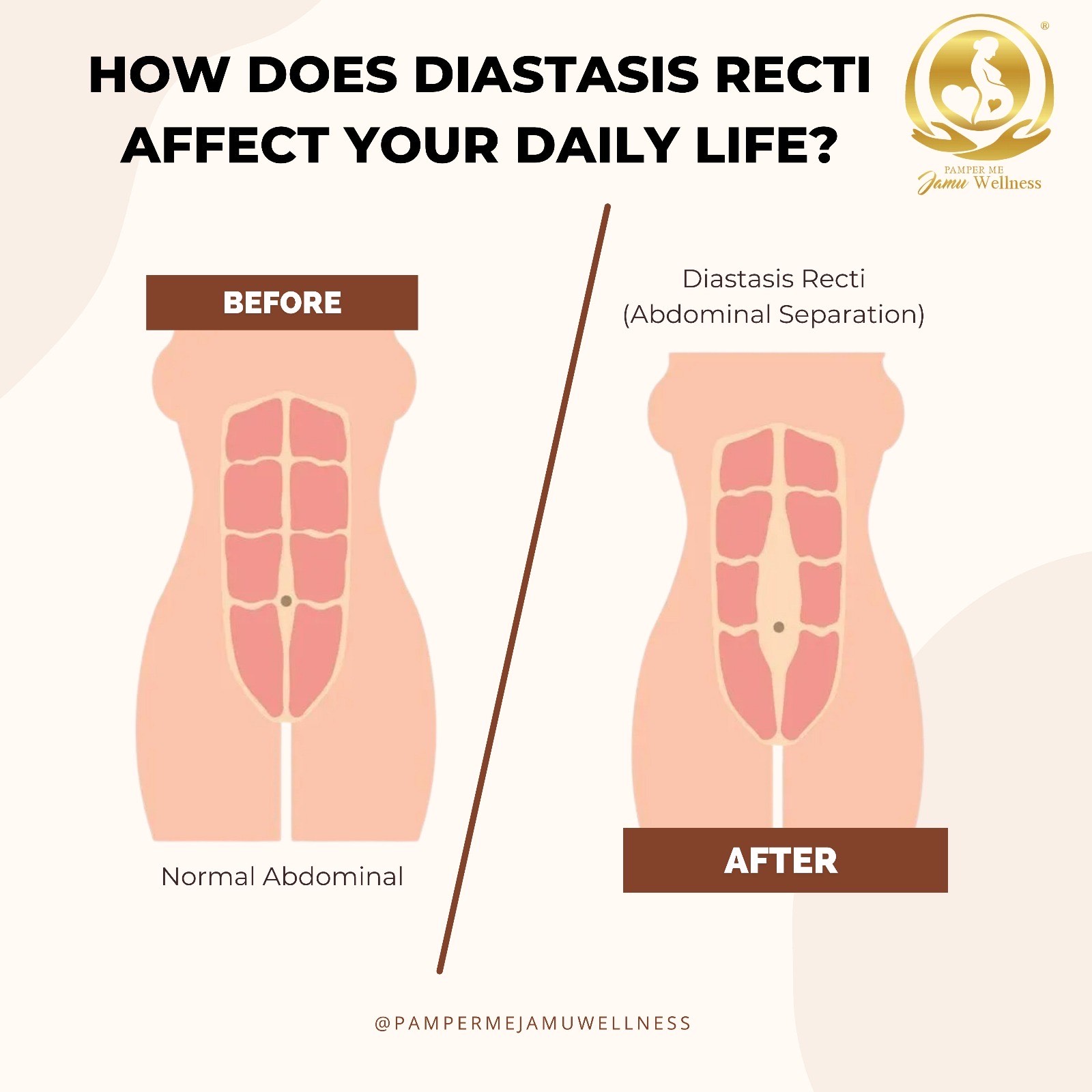 *Deposit First* Pamper Me Jamu Wellness 5 x 90mins Post Natal with Hot Stone Therapy + 5 x 90mins Diastasis Recti Treatment with Hot Stone Therapy